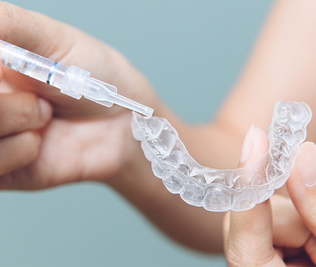 Filling whitening tray with bleaching gel