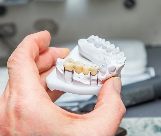 Holding model of teeth with dental bridge