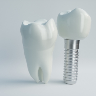 Dental implant standing next to tooth