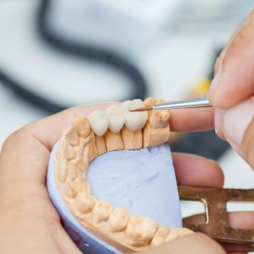 Working on dental bridge attached to model of teeth