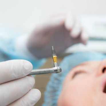 Close up of dental implant during surgery